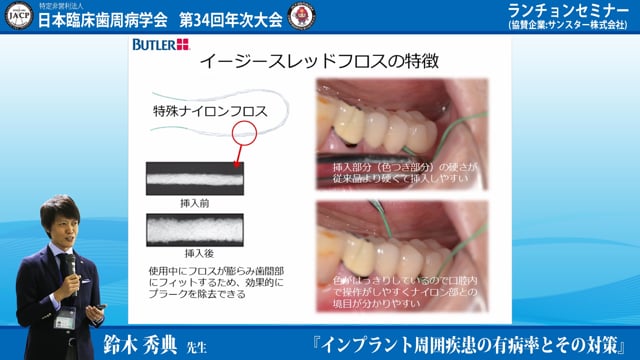 #5 インプラント患者のホームケア清掃具