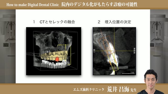 院内のデジタル化がもたらす診療の可能性