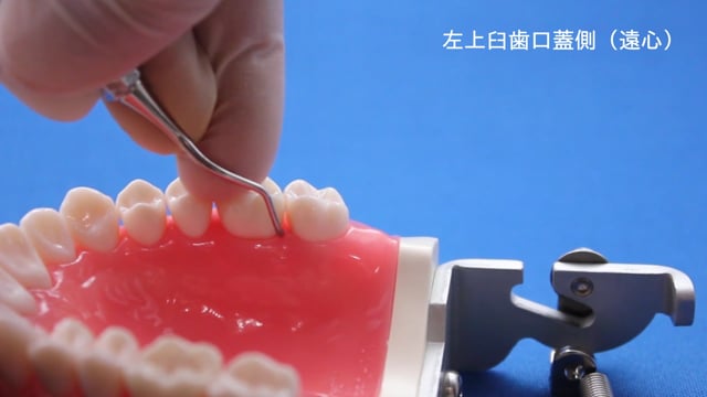 【ユーザー限定】スケーリング基本操作 左上臼歯編