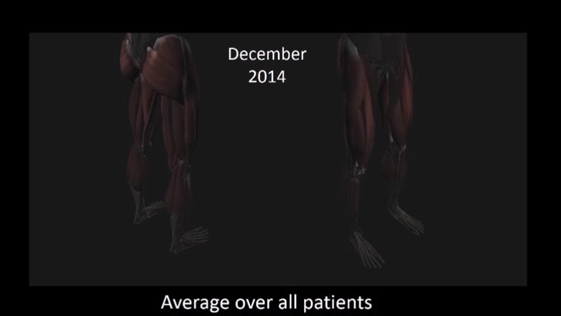 Movie 2 Motor improvement over 12 months of training