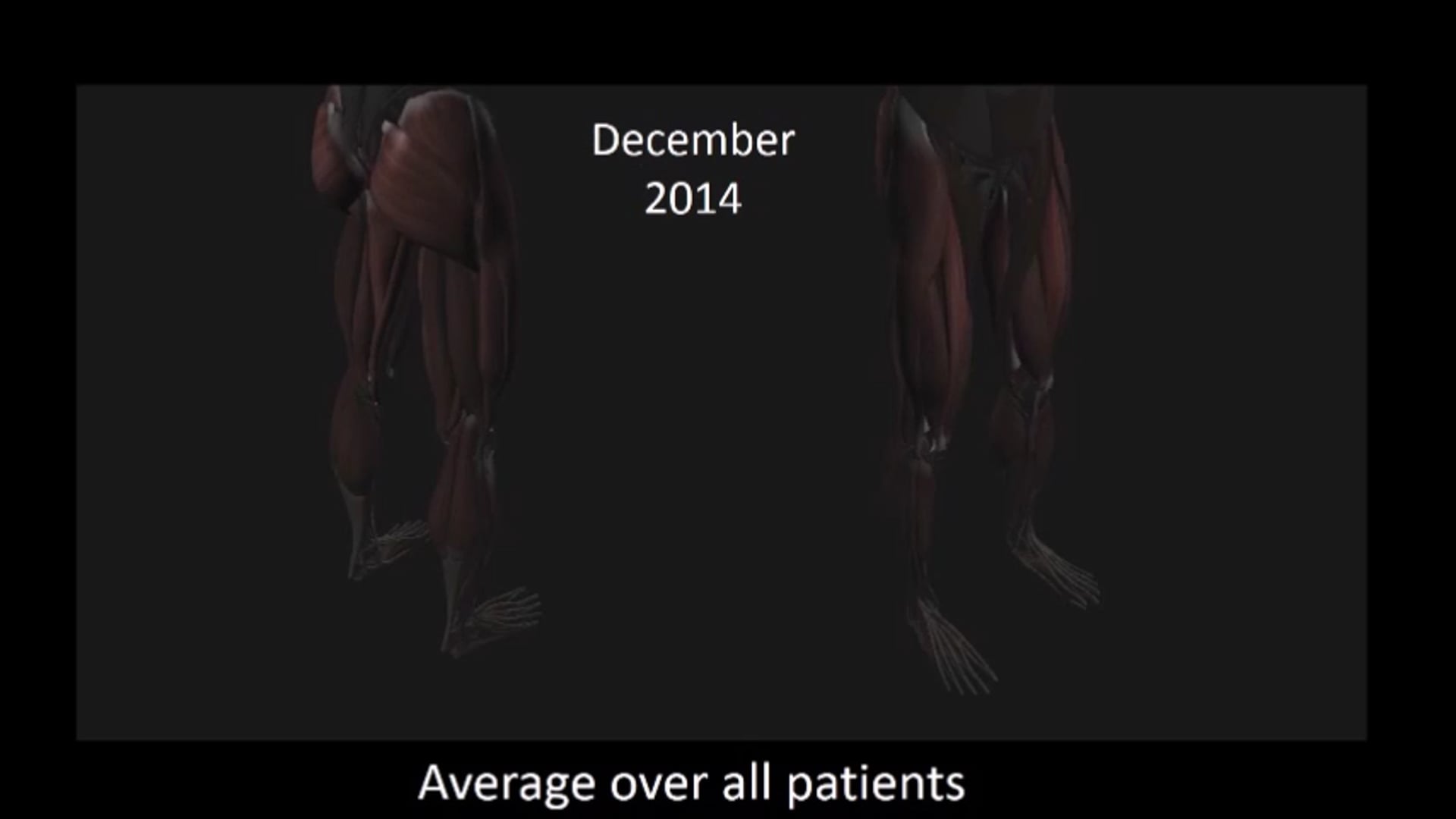 Movie 2 Motor improvement over 12 months of training