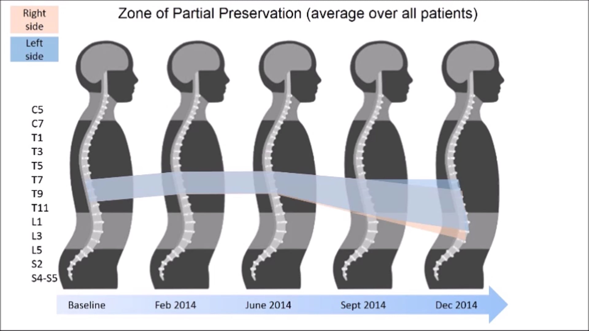 Movie 1 Sensory improvement over 12 months of training