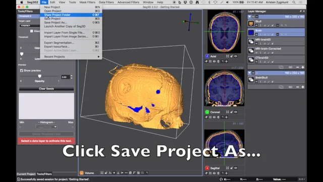 3D slicer Windows 10 Build Fail (only SimpleITK project