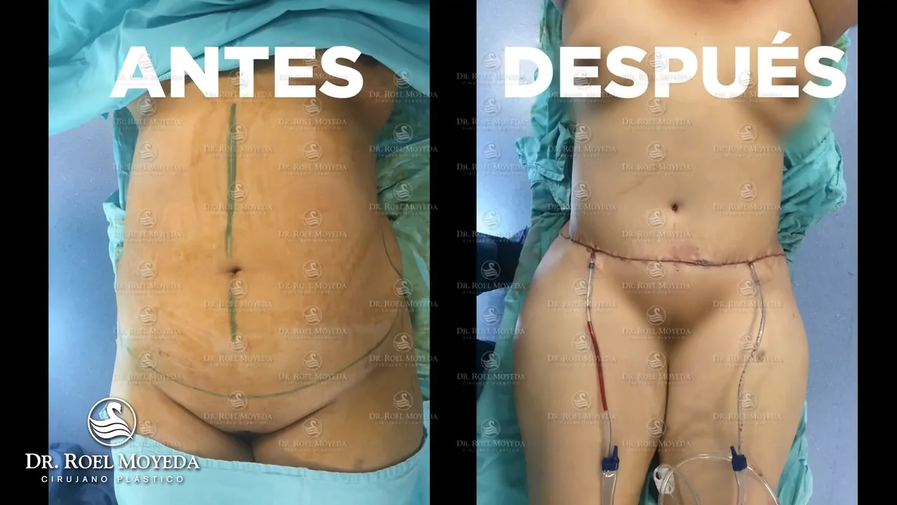 Tratamiento para erupciones de la piel en Monterrey, image size:1280x720