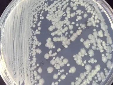 Энтеробактер на эндо. Серрация serratia marcescens. Энтеробактер cloacae. Enterobacter в моче. Цитробактер диверсус.