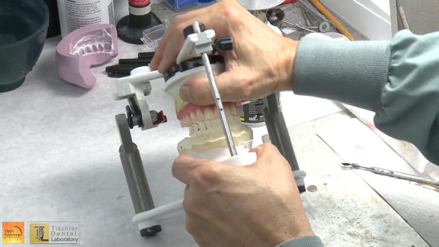 Top Dental Lab Protocols Support Teeth Tomorrow® Practices with Next ...