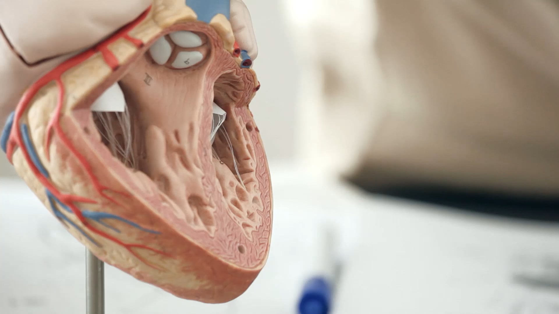 Eucardia, video corporate