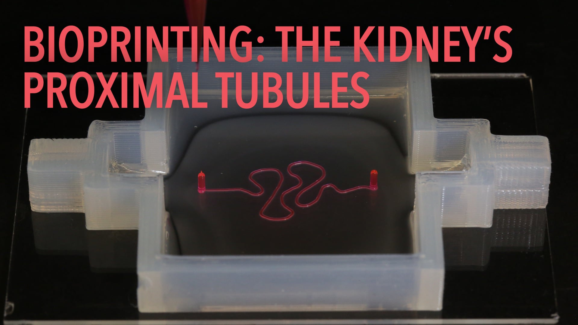 Bioprinting: The Kidney's Proximal Tubules