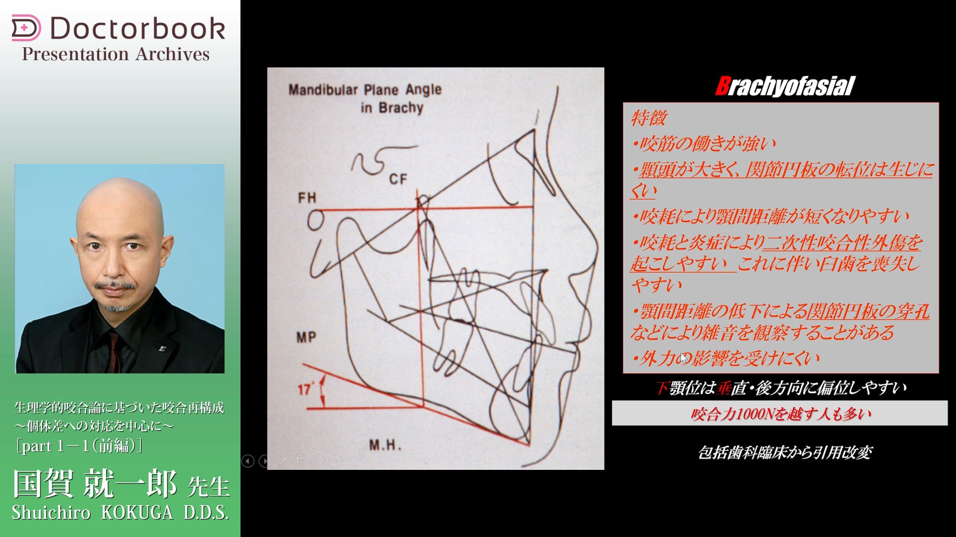 #1 咬合再構築における力の診査・診断