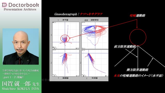 生理学的咬合論に基づいた咬合再構成