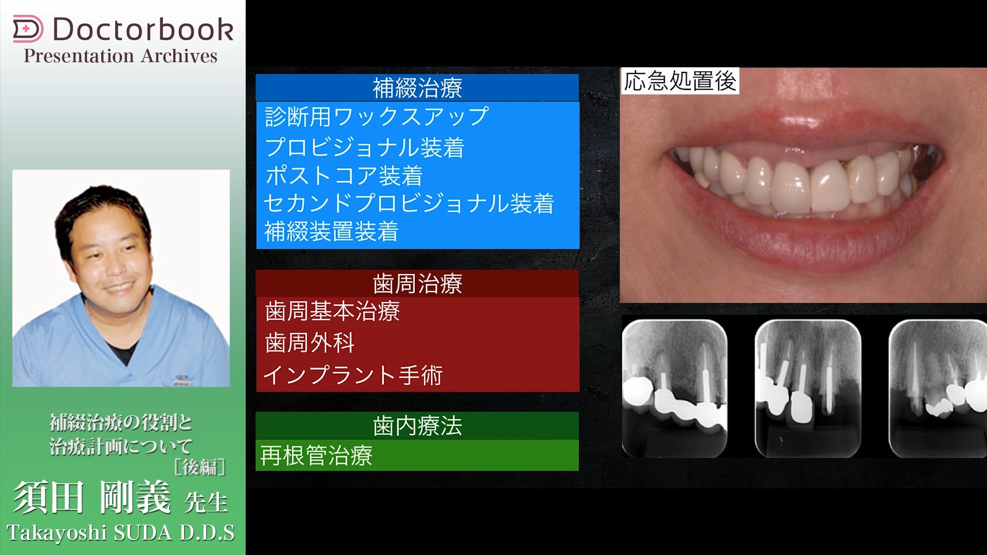 #2 ライフステージを考慮した治療計画