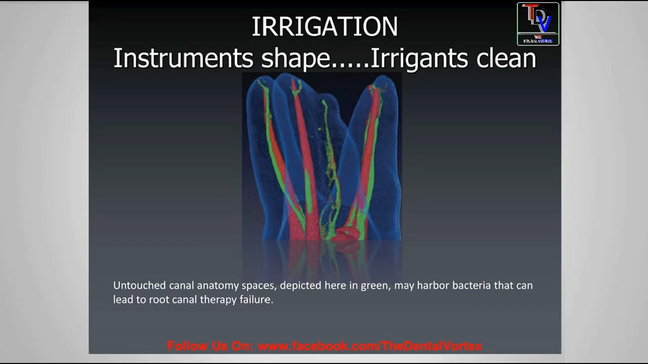 Endodontic Irrigants an Overview on Vimeo