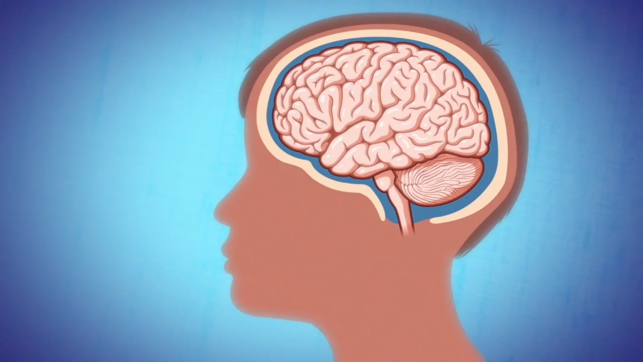 Conmociones Cerebrales, image size:1280x720