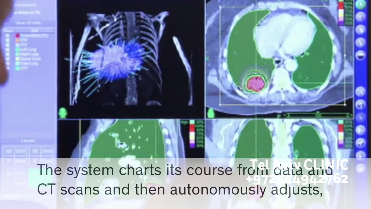 Роботизированная хирургия в Израиле. Отзывы и цены на операции on Vimeo