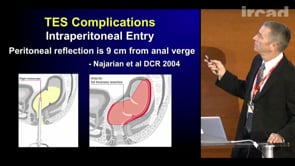 Transanal Endoscopic Surgery: Complications | WebSurg, The Online ...