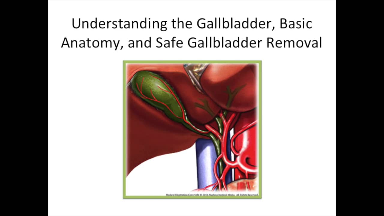 Laparoscopic Cholecystectomy Educational Tutorial: Explaining the ...
