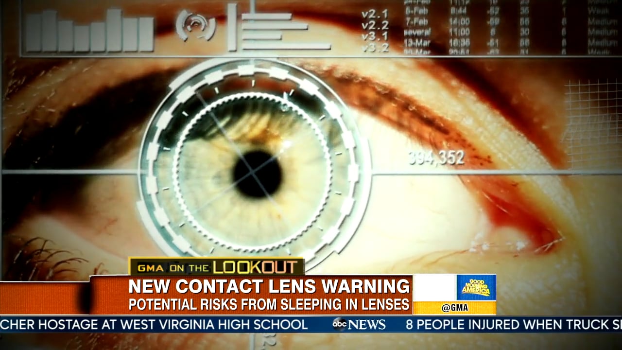 GMA ON THE LOOKOUT CAN CONTACT LENSES MAKE YOU BLIND? on Vimeo