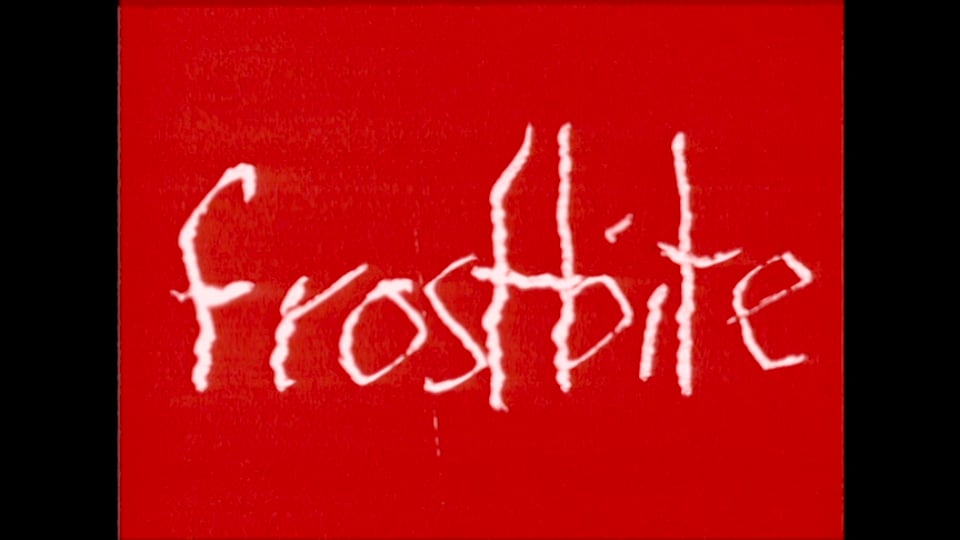 frostbite