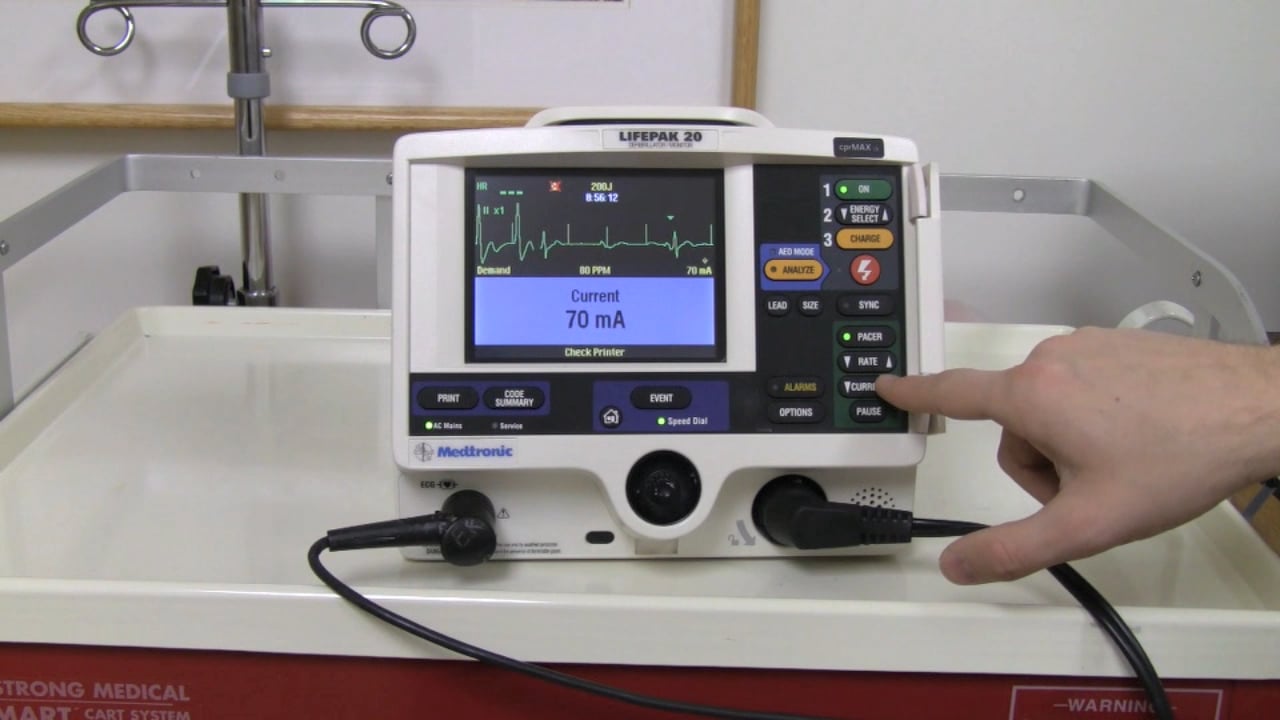 Transcutaneous Pacing on Vimeo