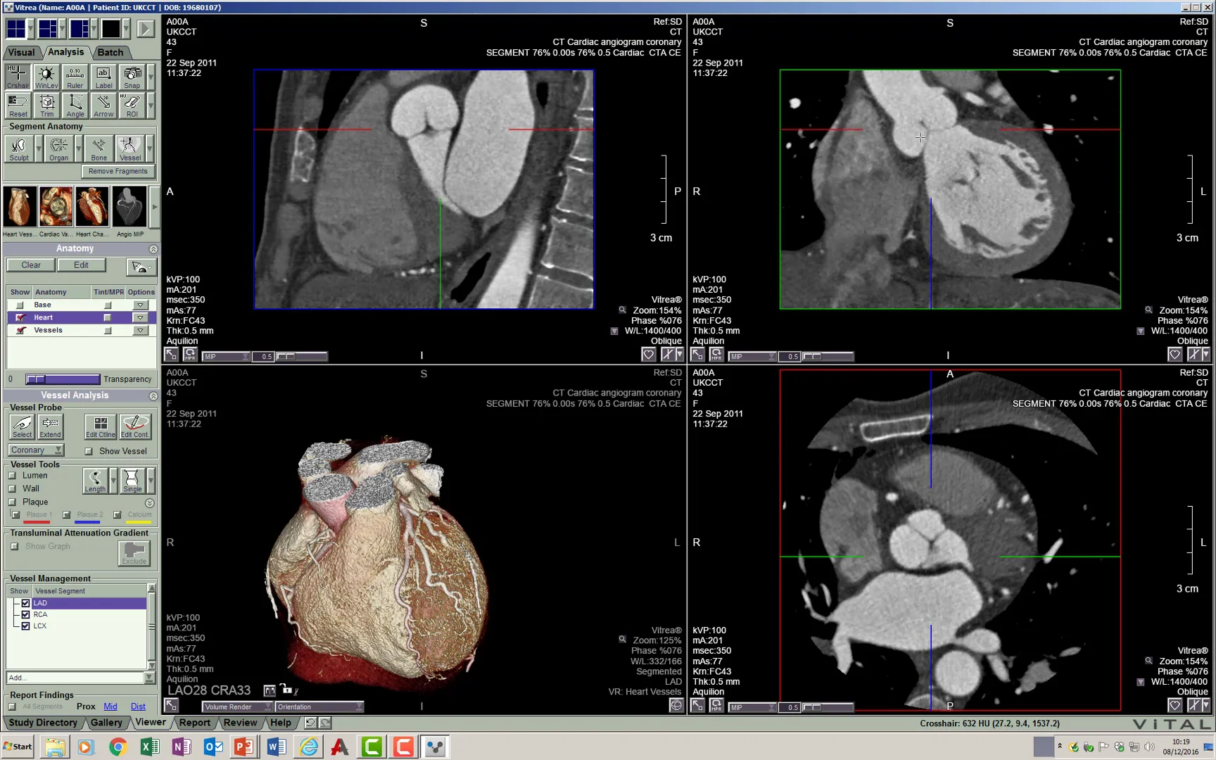 CT image display and reconstruction on Vimeo