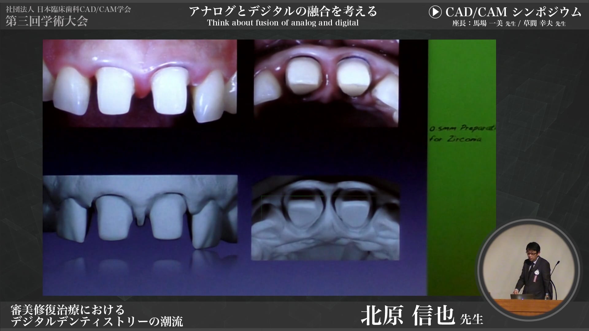 審美修復治療におけるデジタルデンティストリーの潮流