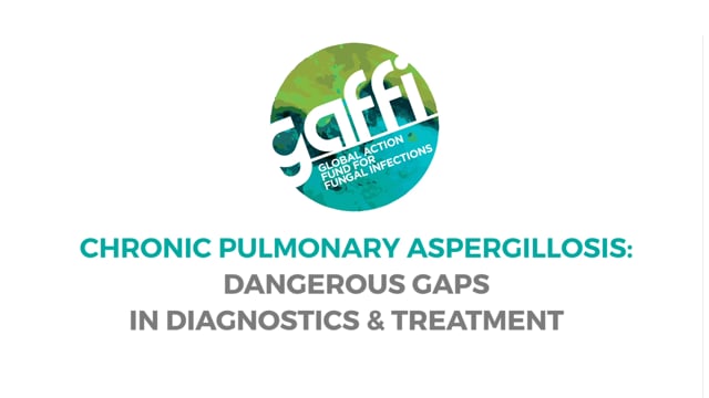 Dec 16, 2016: Chronic Pulmonary Aspergillosis: Dangerous Gaps in Diagnostics & Treatment