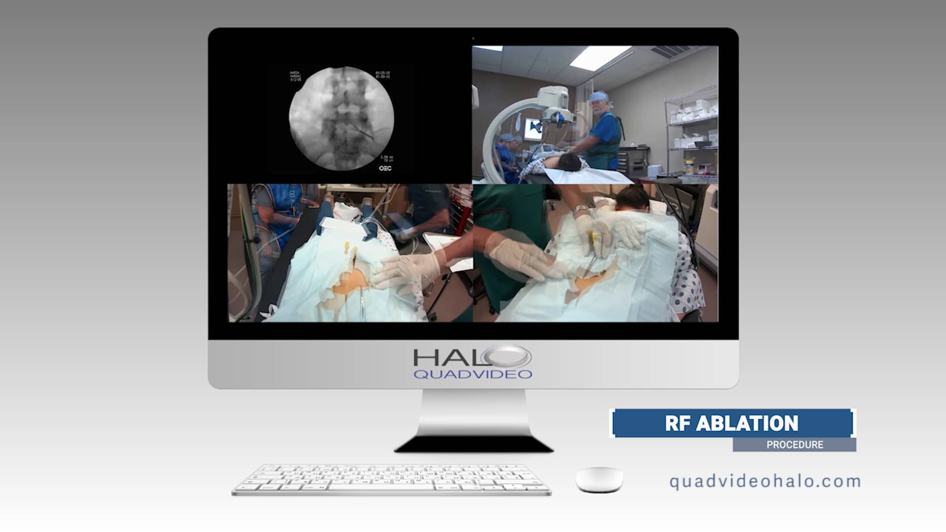 Quad Video HALO Medical Procedure Recordings on Vimeo