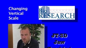 JT-3D Jaw Tracking - Changing Verical Scale