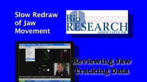 Reviewing Jaw Tracking Data - Slow Redraw of Jaw Movement