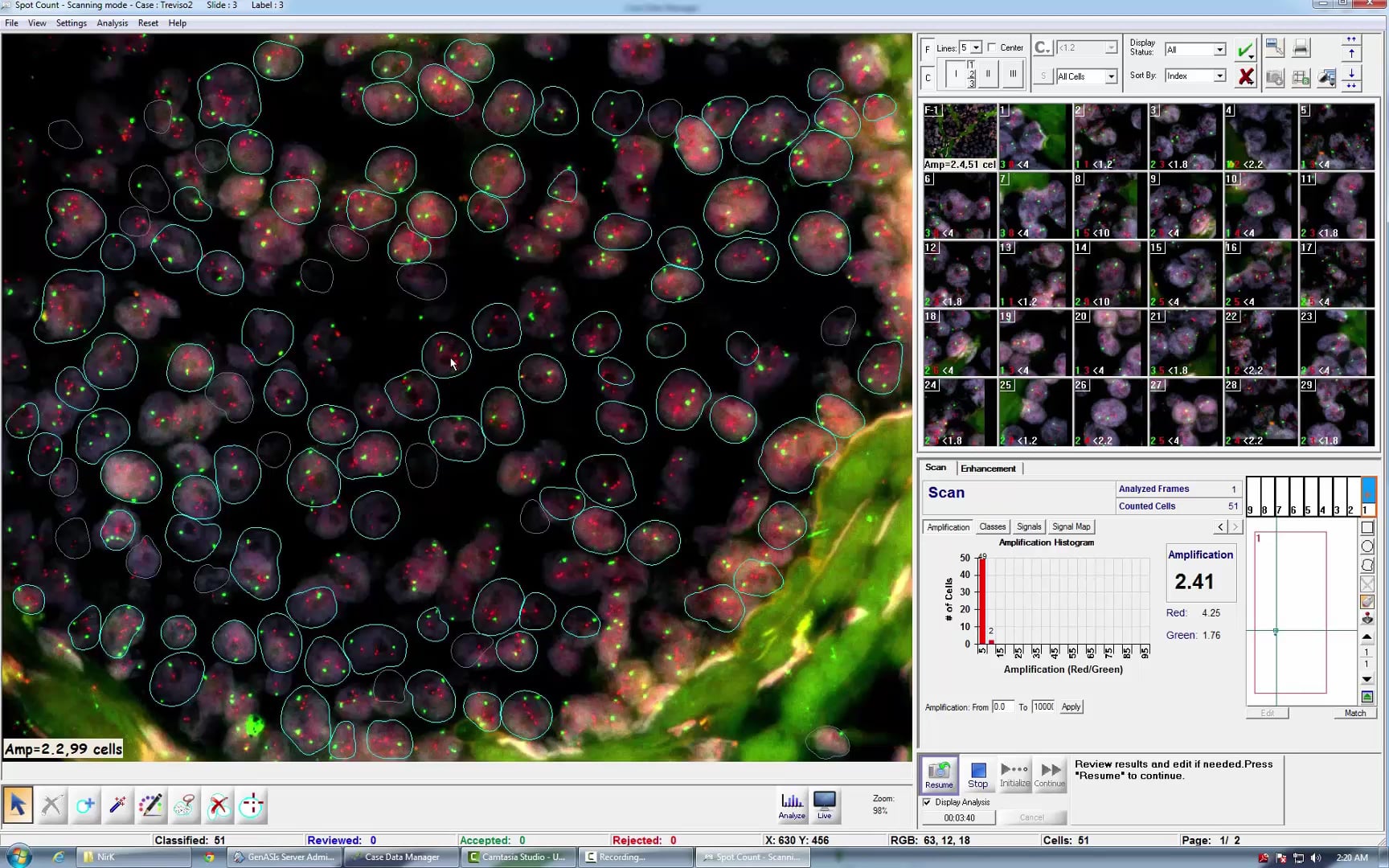 Day 2 - 5 - Automation for FISH Pathology Demo Her2 on Vimeo