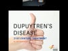Dupuytren's disease - 21st Century Treatment - Dr Jill Tomlinson - 5th July 2016
