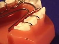 Finger Clasp Adjustment