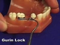 Gurin Lock Adjustment