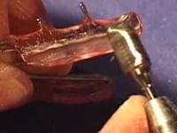 Lower Appliance Lingual Acrylic Adjustment