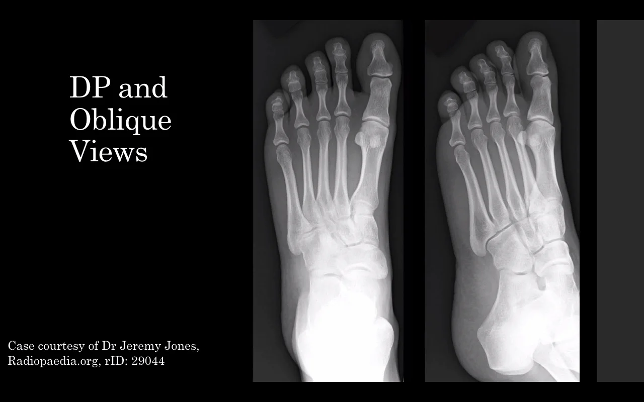 foot bone anatomy xray