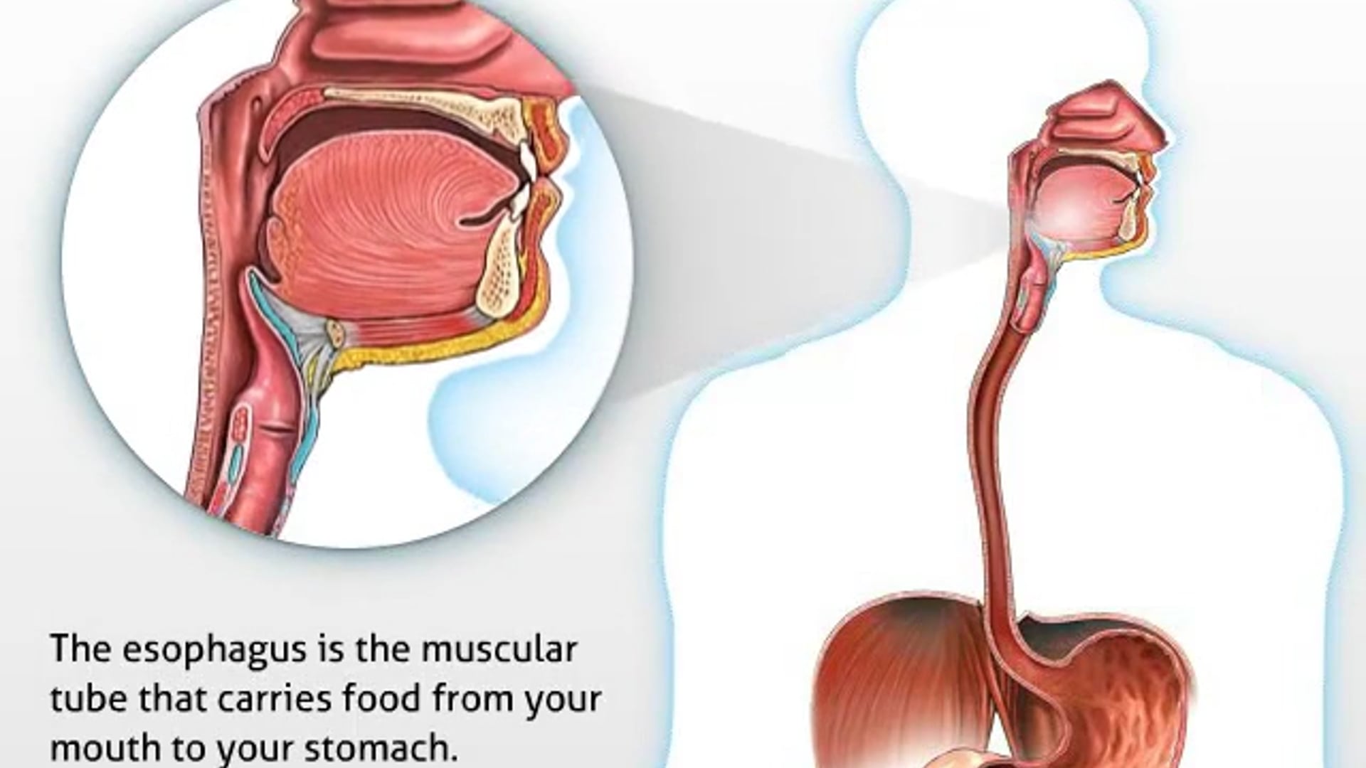 Barrett's Esophagus