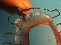 Micro Screw Adjustments