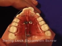 Swing Lock Screw Adjustment