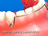 Apron Spring Retraction Bow Description