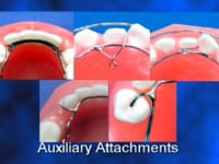 Auxiliaries Springs Description