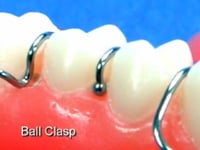 Ball Clasp Description