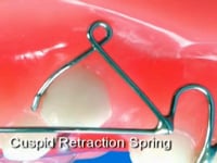 Cuspid Retraction Springs Description