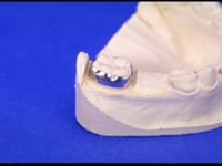 Custom Fabricated Bands Description