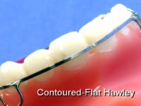 Flat Contoured Labial Bow Description