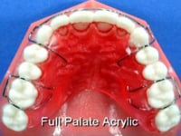 Full Acrylic Palate Description