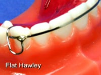 Flat Labial Bow Description