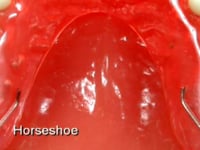 Horseshoe Acrylic Palate Description
