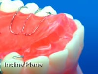 Incline Plane Description