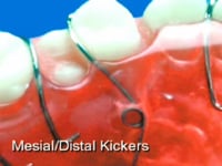 Measil and Distal kicker Spring Discription