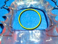 Open Acrylic Palate Description